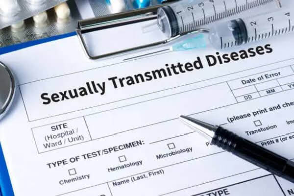 std testing