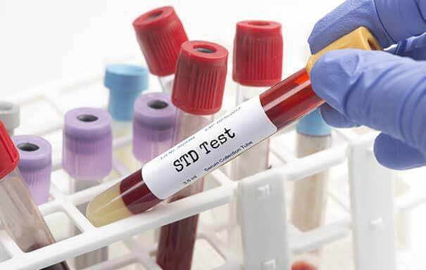 std test