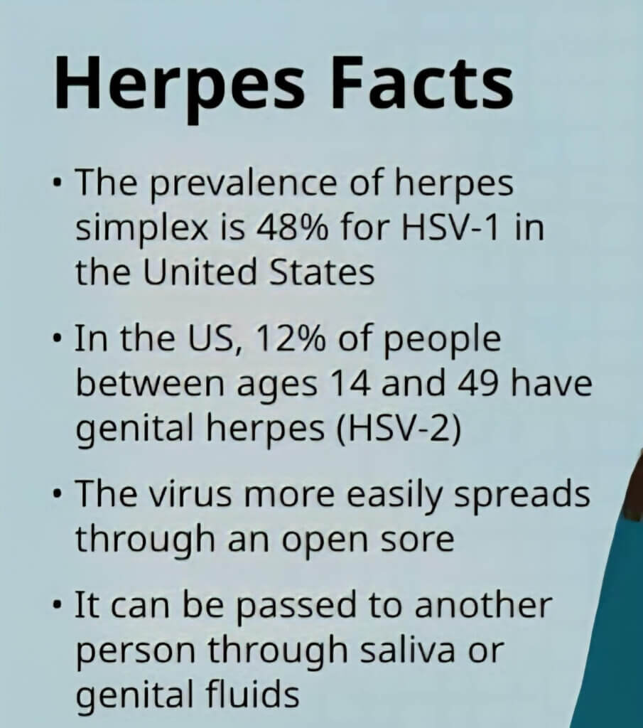 herpes facts